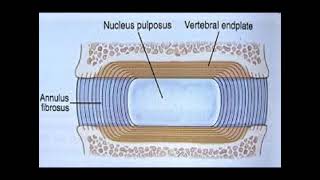 Cervical Disc Herniation [upl. by Toile240]