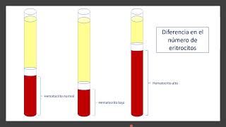 Alteraciones en el hematocrito [upl. by Desdee]