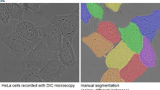 5 Minute Teaser Presentation of the Unet Convolutional Networks for Biomedical Image Segmentation [upl. by Tapes]