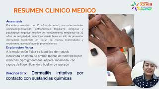 CC 2 Uso de clobetasol en dermatitIs por contacto irritativa por sustancias químicas [upl. by Ayhdiv]