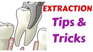 Exodontia Tips amp Tricks  Diagnosis amp Treatment Panning  Indication Medical amp Dental Evaluation [upl. by Desirae]