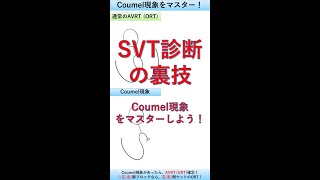 【SVT診断の裏技】Coumel現象をマスターしよう！ shorts [upl. by Eniretac234]