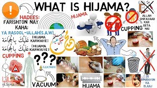 What is Hijama  Sunnah Way of Treatment  Maulana Tariq Jameel Animated [upl. by Lindsay]