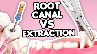 Root Canal vs Tooth Extraction What’s the Right Choice [upl. by Conny850]