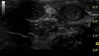 ultrasonography emphysematous anal sacculitis in a dog [upl. by Alleuqahs]