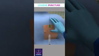 Lumbar Puncture Basic Skills shorts [upl. by Omura]