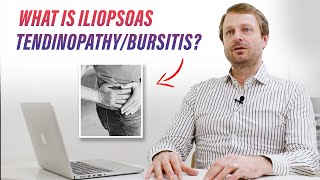 What is iliopsoas tendinopathybursitis [upl. by Tevlev678]