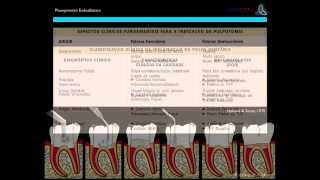 Planejamento do Diagnóstico e Tratamento Endodôntico [upl. by Livingston384]