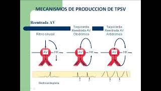 Taquiarritmias  Curso Residentado Médico  Cardiología [upl. by Hermine]