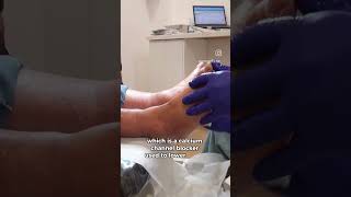 Swollen feet 😱 footwellness feet swollenankles [upl. by Sackville251]