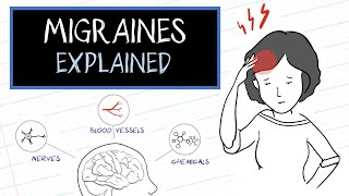 What are Migraines HealthSketch [upl. by Wickham683]