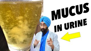 Mucus in Urine  मूत्र में म्यूकस  DrEducation [upl. by Hoffer]