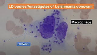 LD bodies Amastigotes of Leishmania donovani in skin smear of a cutaneous leishmaniasis patient [upl. by Sucramrej159]