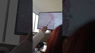 aparato femenino parte 2 HISTOLOGIA LOPEZ [upl. by Eberly584]