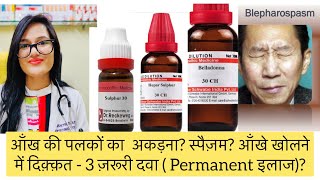 आँख की पलकों में अकड़न आँखे बंद होना Blepharospasm Top 5 Homeopathic Medicine  Dr By Rukmani [upl. by Janeczka327]