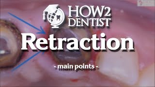 How to use retraction cords in dentistry  How to Dentist [upl. by Harper]