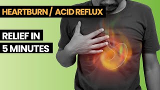 Reduce Your Heart Burn  GERD In 5 Mins  Acid Reflux Treatment [upl. by Adnamor884]