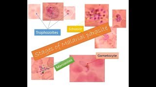 Malarial parasites identification within two minutes  Trophozoite Schizont Gametocyte Merozoite [upl. by Ibba121]