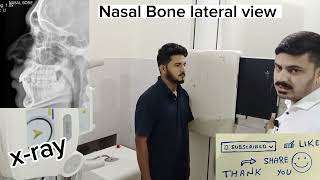 Nasal Bone xray position in Urdu Hindidoctor hospital mbbs dr physiotherapy [upl. by Eselahc34]