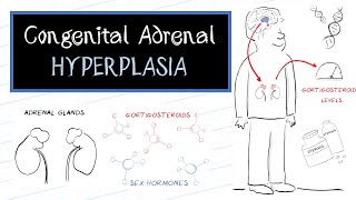 What is Congenital Adrenal Hyperplasia CAH [upl. by Favien]