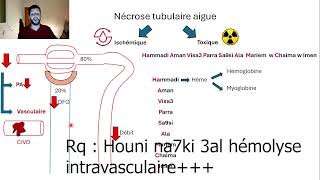 9Mecanismes nécrose tubulaire aigue [upl. by Barrow]