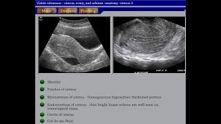 Ultrasound Course of Gynecology Part 01 [upl. by Nwonknu]