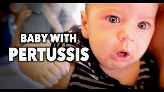 BABY WITH PERTUSSIS Whooping Cough  Dr Paul [upl. by Tanah20]