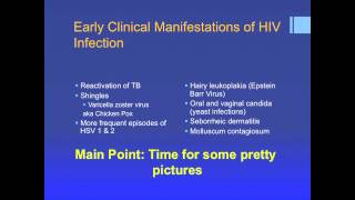 HIV Manifestations of Disease with Lisa HightwoWeidman  UNC AIDS Course Lecture 3 [upl. by Abigale]