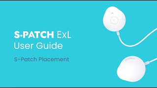 SPatch ExL User Guide SPatch Placement [upl. by Klute]