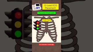 12 Lead ECG placement ECG leads kaise lagay ecg biology shorts youtubeshorts youtube [upl. by Lundell891]