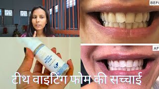 Teeth whitening foam kaise use kare  teeth whitening foam ki sachchai  teethwhitening [upl. by Iliram126]