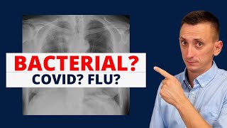 Covid Influenza Pneumonia [upl. by Nas]