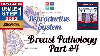 Breast pathologyCancer from Pathoma in urdu Part4 Reproductive system pathUrduHindi [upl. by Atiekram197]