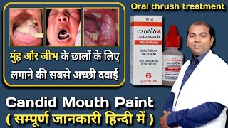 Candid mouth paint uses and side effects [upl. by Radferd]