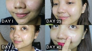 SOMEBYMI 30 days Miracle Toner UPDATE  H7 HydroMax Cream Review [upl. by Cynera371]