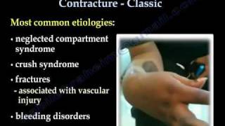 Volkmanns Ischemic Contracture Classic  Everything You Need To Know  Dr Nabil Ebraheim [upl. by Esoranna]