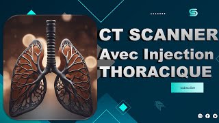 CT Scanner THORACIQUE Avec Injection  Partage de Pratiques [upl. by Ettolrahs]