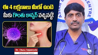 గొంతు కాన్సర్ లక్షణాలు  Throat Cancer Symptoms in Telugu  Dr Chava Anjaneyulu  Socialpost Health [upl. by Louie]