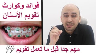 تقويم الأسنان سلاح ذو حدين لو هتعمل تقويم؟ ده أهم فيديو لااازم تشوفه [upl. by Anerak]