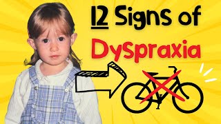 Could you actually have Dyspraxia DCD [upl. by Macleod]