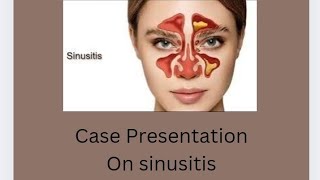 Case Presentation on sinusitis nursing care plansinusitis for Bsc nursing and GNM student [upl. by Latty]