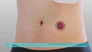 Confort Colostomy Ileostomy Bag Application Video [upl. by Lunnete409]