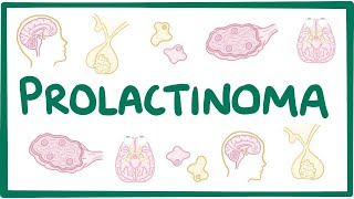 Prolactinoma  causes symptoms diagnosis treatment pathology [upl. by Jacinto792]