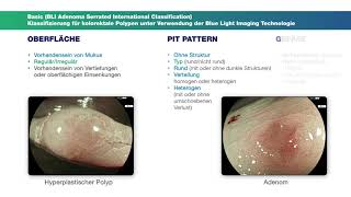 BasicKlassifikation Kolonpolypen [upl. by Mazman]