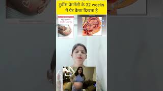 Twins pregnancy ke 32 weeks me pet kaisa dikhta hai belly in 32 weeks twins pregnancy in hindi [upl. by Tutto]