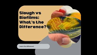 Slough vs Biofilms A clear Distinction [upl. by Htiaf]