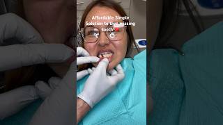 Missing tooth  Implant too pricey  Watch this Simple solution ❤️ [upl. by Esdras]