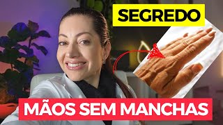 O Segredo para Mãos Perfeitas e Livre de Manchas Descubra Agora  Dra Greice Moraes [upl. by Rehpetsirhc962]