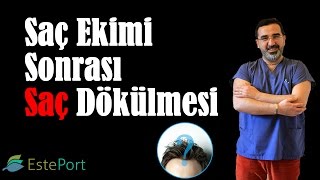 Saç Ekimi Sonrası Saç Dökülmesi [upl. by Eiramac]