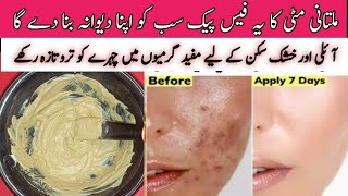 Multani mitti face pack for acne and glowing skinHow to remove acne from face Multani mitti pack [upl. by Alabaster573]